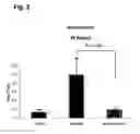 Fig. 03 - Method and pharmaceutical compositions for treating or inhibiting renal dysfunctions, diseases or disorders, particularly in diabetic patients