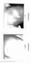 Fig. 07 - Treating eczema and/or psoriasis