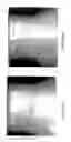 Fig. 12 - Treating eczema and/or psoriasis