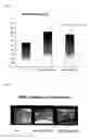 Fig. 02 - Method for treating inflammatory bowel diseases