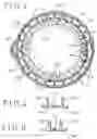 Fig. 04 - External counterpulsation cardiac assist device