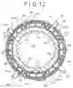 Fig. 08 - External counterpulsation cardiac assist device