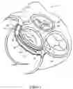 Fig. 02 - Tissue shaping device with self-expanding anchors