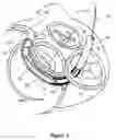 Fig. 06 - Tissue shaping device with self-expanding anchors