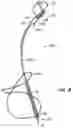 Fig. 08 - Tissue shaping device with self-expanding anchors