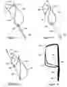 Fig. 10 - Tissue shaping device with self-expanding anchors