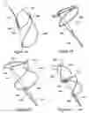 Fig. 12 - Tissue shaping device with self-expanding anchors