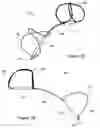 Fig. 16 - Tissue shaping device with self-expanding anchors