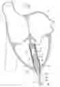 Fig. 02 - Device for covering a tissue region on a wall of a heart