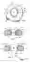 Fig. 02 - Retractor with inflatable blades