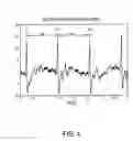 Fig. 07 - Method and apparatus for low blood glucose level detection