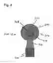 Fig. 04 - Reducing movement artifacts in magnetic resonance measurements
