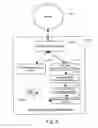 Fig. 08 - System and method for acquiring breathing pattern signals from intracardiac electrograms and its use for heart failure therapy decision making and disease monitoring