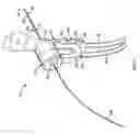 Fig. 02 - Method of opening a ductal sphincter using controlled fluid pressure