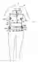 Fig. 01 - Adjustable, interlocking lliac crest belt for body brace