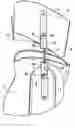 Fig. 01 - Removable and adjustable, multi-component connection element, and orthosis containing such an element
