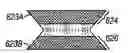Fig. 01 - Devices for maintaining surgically created openings