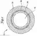 Fig. 03 - Composite catheter braid