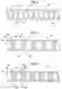 Fig. 05 - Composite catheter braid