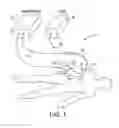 Fig. 02 - System and method for delivering a substance to a body cavity