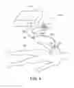 Fig. 04 - System and method for delivering a substance to a body cavity