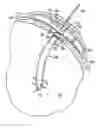 Fig. 01 - Implantable refillable and ported controlled release drug delivery device