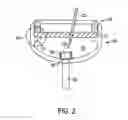 Fig. 03 - Implantable refillable and ported controlled release drug delivery device