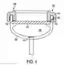 Fig. 05 - Implantable refillable and ported controlled release drug delivery device