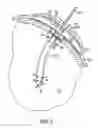 Fig. 06 - Implantable refillable and ported controlled release drug delivery device