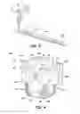 Fig. 04 - Use of swirl-like adhesive patterns in the formation of absorbent articles
