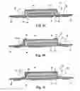 Fig. 03 - Sanitary absorbent article having a reinforced structure