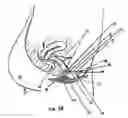 Fig. 07 - Bodily exudate capturing article