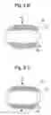 Fig. 05 - Interlabial pad