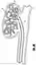 Fig. 06 - Activatable bioactive implantable medical device and method of use