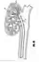 Fig. 07 - Activatable bioactive implantable medical device and method of use