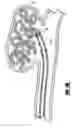 Fig. 06 - Activatable bioactive implantable medical device and method of use