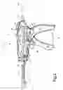 Fig. 03 - Minimally invasive injection devices and methods