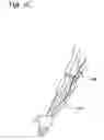 Fig. 03 - Catheters with tracking elements and permeable membranes