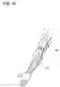 Fig. 03 - Permeable membrane catheters, systems, and methods