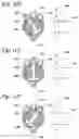 Fig. 13 - Permeable membrane catheters, systems, and methods