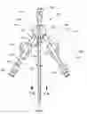 Fig. 02 - Catheter button hub