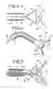 Fig. 03 - Back loading endoscopic instruments