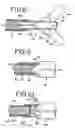 Fig. 05 - Back loading endoscopic instruments