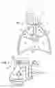 Fig. 02 - Apparatus and method for resecting and removing selected body tissue from a site inside a patient
