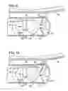 Fig. 06 - Apparatus and method for resecting and removing selected body tissue from a site inside a patient