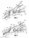 Fig. 03 - Vessel sealing instrument