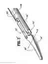 Fig. 04 - Vessel sealing instrument