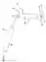 Fig. 09 - Temporary spinal fixation apparatuses and methods