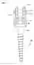 Fig. 10 - Temporary spinal fixation apparatuses and methods