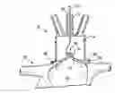 Fig. 01 - Universal cardiac introducer